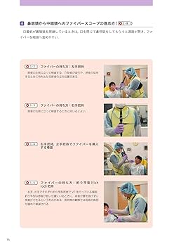 目でみる嚥下障害 第2版 Web動画付 嚥下内視鏡検査(VE)・嚥下